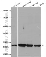 ACADM Polyclonal antibody proteintech 55210-1-AP