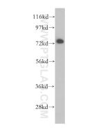 BRD7 Polyclonal antibody proteintech 51009-2-AP
