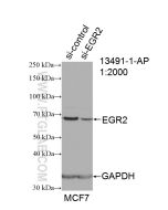 EGR2 Polyclonal antibody proteintech 13491-1-AP