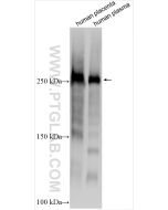 VWF Polyclonal antibody proteintech 27186-1-AP