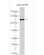 TGFBR3 Polyclonal antibody proteintech 28992-1-AP