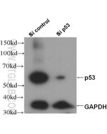 P53 Polyclonal antibody proteintech 21891-1-AP