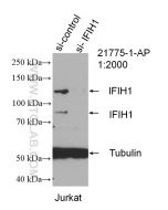 IFIH1/MDA5 Polyclonal antibody proteintech 21775-1-AP