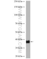 Aldolase C Polyclonal antibody proteintech 14884-1-AP