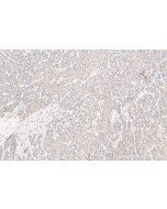 CXCL12/SDF-1 Polyclonal antibody proteintech 17402-1-AP