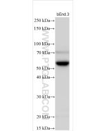 OLR1/LOX1 Polyclonal antibody proteintech 11837-1-AP