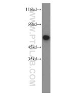FKBP5 Polyclonal antibody proteintech 14155-1-AP