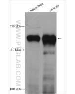 NF-H/NF200 Polyclonal antibody proteintech 18934-1-AP