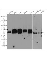 TFEB Polyclonal antibody proteintech 13372-1-AP