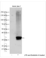 IL-1 beta Polyclonal antibody proteintech 26048-1-AP