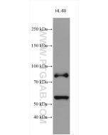 MPO Polyclonal antibody proteintech 22225-1-AP