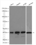 PSAT1 Polyclonal antibody proteintech 10501-1-AP