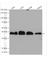 SCD1 Polyclonal antibody proteintech 28678-1-AP