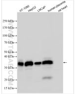GDF-15 Polyclonal antibody proteintech 27455-1-AP
