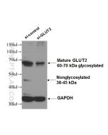 GLUT2 Polyclonal antibody proteintech 20436-1-AP
