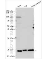 Ferritin heavy chain Polyclonal antibody proteintech 11682-1-AP