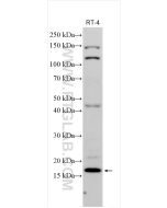 DNLZ Polyclonal antibody proteintech 31844-1-AP