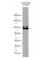 LHCGR Polyclonal antibody proteintech 19968-1-AP
