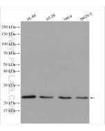 TIMP1 Polyclonal antibody proteintech 16644-1-AP