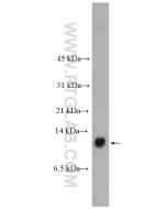 S100A14 Polyclonal antibody proteintech 10489-1-AP