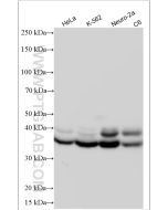 HNRNPA1 Polyclonal antibody proteintech 11176-1-AP