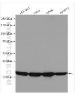 LDHA-Specific Polyclonal antibody proteintech 19987-1-AP