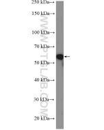 E2F1 Polyclonal antibody proteintech 12171-1-AP