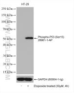 Phospho-P53 (Ser15) Polyclonal antibody proteintech 28961-1-AP