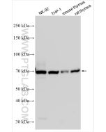 TNFR2/CD120b Polyclonal antibody proteintech 19272-1-AP