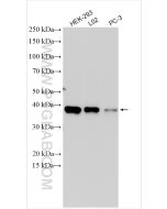 SIX2 Polyclonal antibody proteintech 11562-1-AP