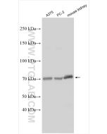 TM9SF4 Polyclonal antibody proteintech 29520-1-AP