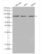 Methylmalonyl Coenzyme A mutase/MUT Polyclonal antibody proteintech 17034-1-AP