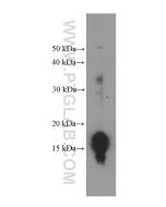 Pan Acetylation Monoclonal antibody proteintech 66289-1-Ig
