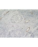 VWF Monoclonal antibody proteintech 66682-1-Ig