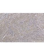 IL-23 p19 Monoclonal antibody proteintech 66196-1-Ig