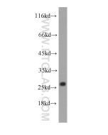 Cytoglobin Monoclonal antibody proteintech 60228-1-Ig