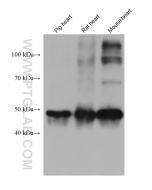 Calsequestrin 2 Monoclonal antibody proteintech 66419-1-Ig
