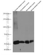 CAPN3 Monoclonal antibody proteintech 67366-1-Ig