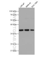 FRZB Monoclonal antibody proteintech 67081-1-Ig