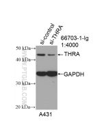 THRA Monoclonal antibody proteintech 66703-1-Ig