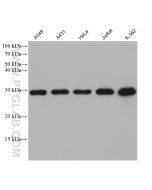 GSTO1 Monoclonal antibody proteintech 60150-2-Ig