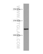 ERAP2 Monoclonal antibody proteintech 67477-1-Ig