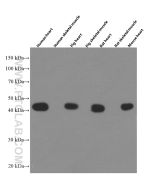 Alpha cardiac muscle actin specific Monoclonal antibody proteintech 66125-1-Ig