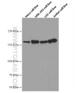 TOP2A Monoclonal antibody proteintech 66541-1-Ig