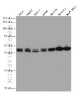 ADK Monoclonal antibody proteintech 66929-1-Ig
