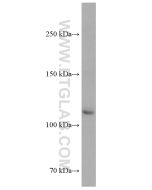 ASK1 Monoclonal antibody proteintech 67072-1-Ig