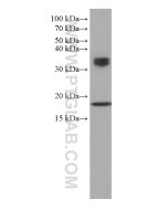 BST2 Monoclonal antibody proteintech 66919-1-Ig