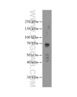 Mesothelin Monoclonal antibody proteintech 66404-1-Ig