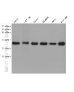 GSTP1 Monoclonal antibody proteintech 66715-1-Ig
