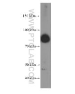 BCL6 Monoclonal antibody proteintech 66340-1-Ig